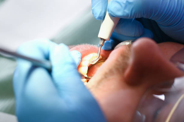 Best Emergency Root Canal Treatment in Palmer, TX